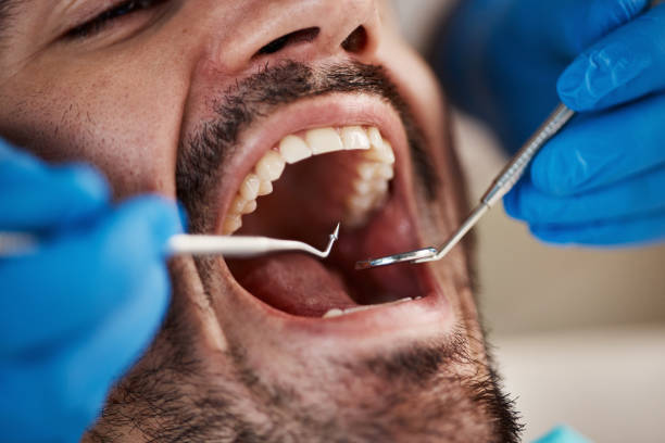 Best Urgent Care for Lost Fillings or Crowns in Kapaau, HI
